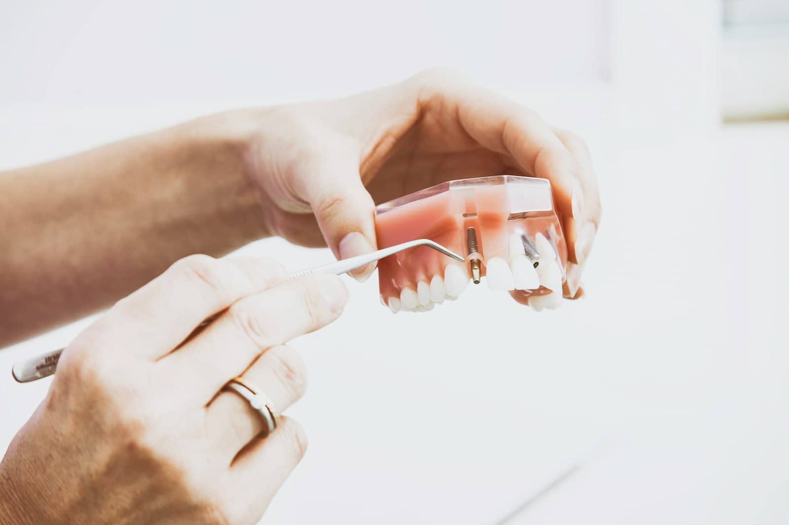 The Ultimate Guide to High-Quality Dental Care: Implants, Cosmetic Dentistry, and More